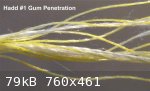Hadd Gum Penetration (760 x 461).jpg - 79kB