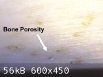 Bone Porosity (600 x 450).jpg - 56kB